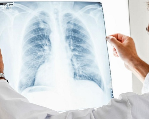 ¿Cómo se diagnostica un nódulo pulmonar?