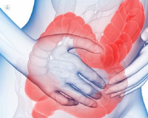 Principales causas del síndrome del intestino irritable