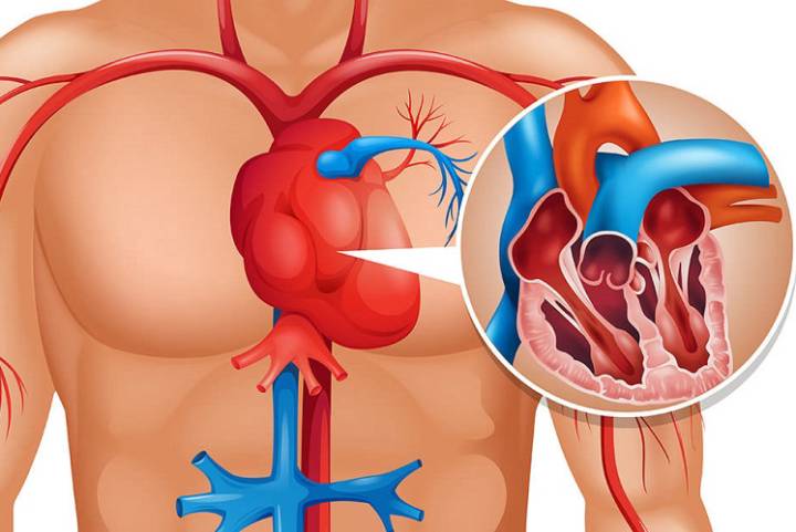 principales-sintomas-que-se-manifiestan-antes-de-sufrir-un-infarto imágen de artículo