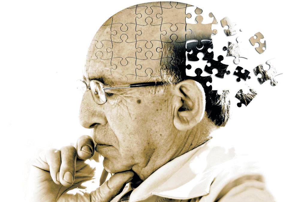 Estados Unidos aprueba el primer medicamento contra Alzheimer en dos décadas