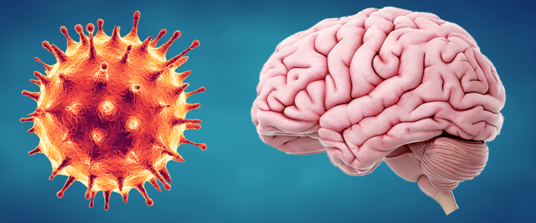 COVID-19 provoca inflamación cerebral similar al Alzheimer o al Parkinson