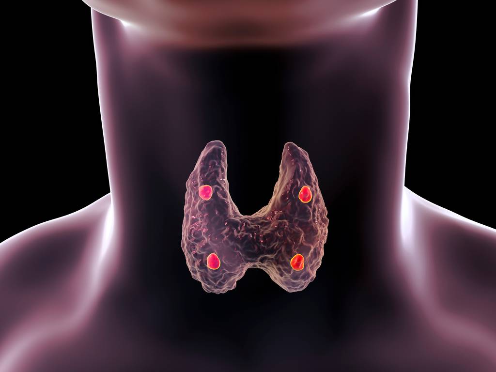 cancer-de-tiroides-causas-sintomas-y-tratamiento imágen de artículo