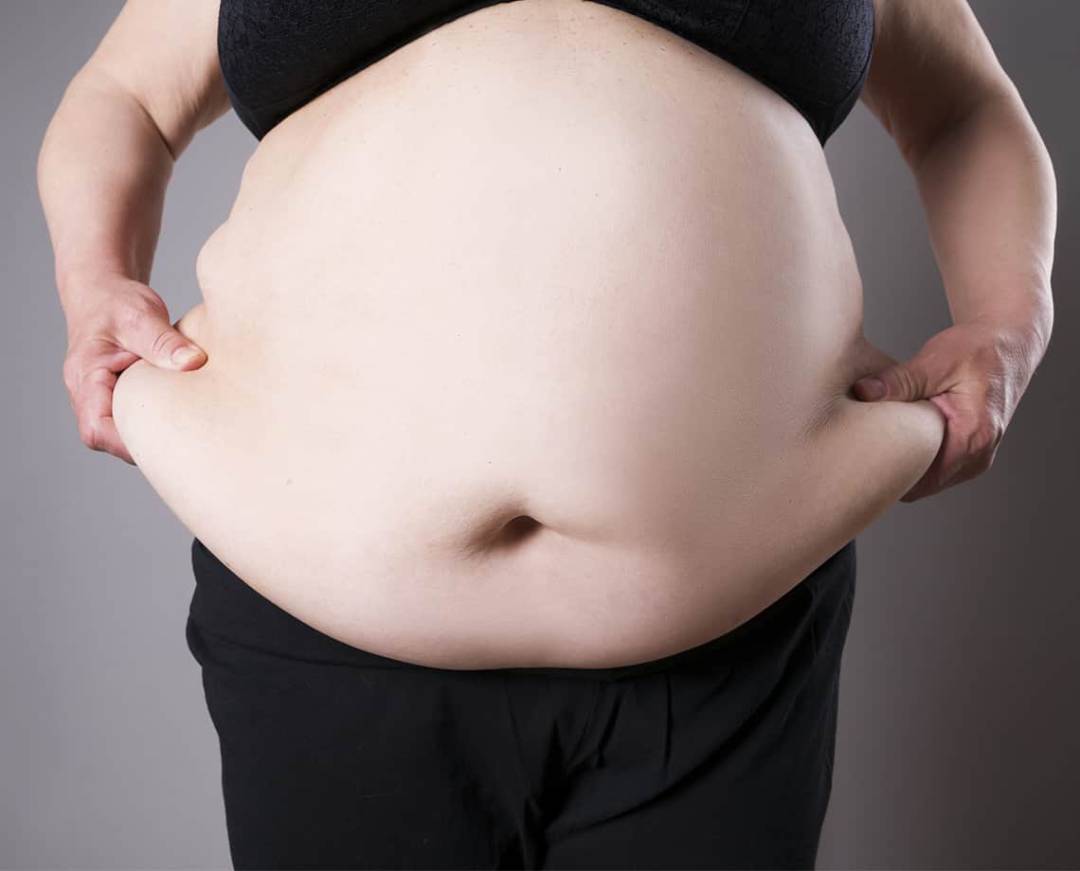 Cirugía de la Obesidad: tipos, procedimiento y resultados