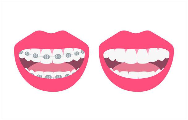 los-beneficios-de-la-ortodoncia-correctiva imágen de artículo