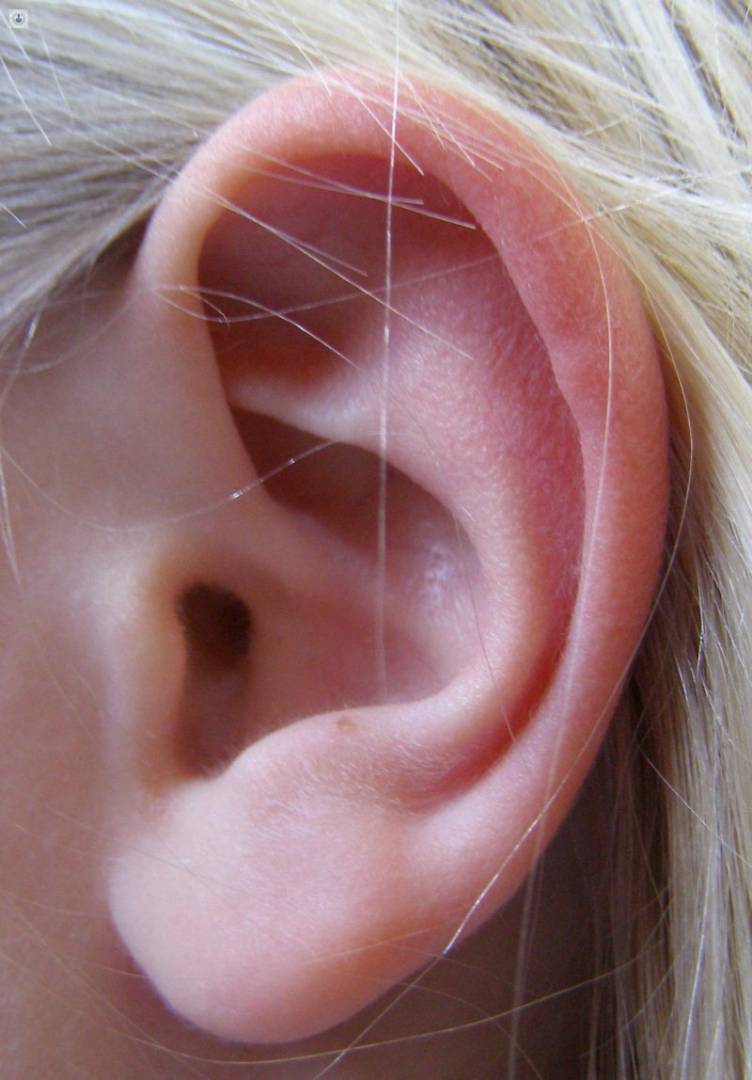 cirugia de orejas